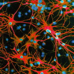 نقش مهم سلول های ستاره ای در تهیه نقشه عظیم مغز