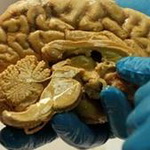 مغز بزرگ، چطور انسان را به باهوش‎ترین موجود روی زمین تبدیل کرد؟